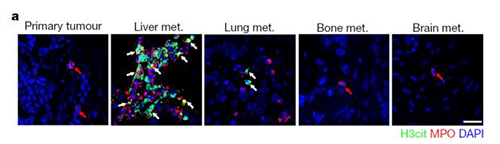 转入小鼠模子获得相同的试验效果，，，，，，且在转移爆发前NET已在肝脏聚积。。。。。。。