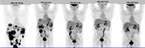 使用PET展望药物的恒久药效