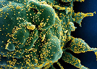 唾液检测新冠抗体新要领来了，，，，，获取效果仅需几小时！