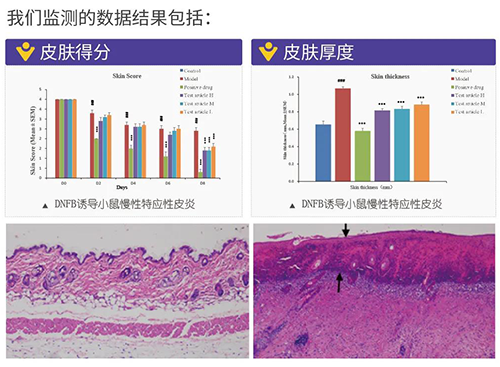 威客电竞建设的特应性皮炎及湿疹模子监测数据效果