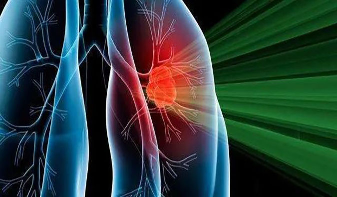 盛世泰科1类立异药物CGT-9475实现中美双报双批 | 威客电竞一站式临床宿世物医药研发效劳平台助力