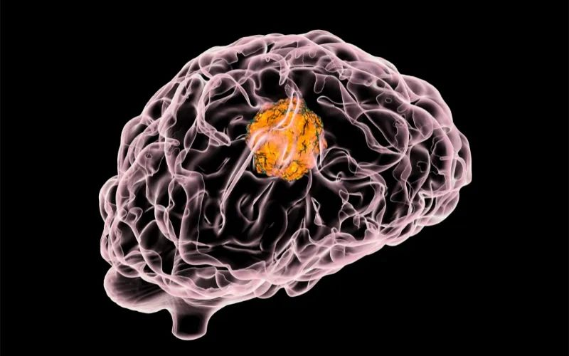 威客电竞助力 | 璧辰医药ABM-1310获美国FDA孤儿药资格认证，，，，，用于治疗携带BRAF V600突变的脑胶质母细胞瘤患者